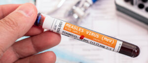 person holding a vial of blood